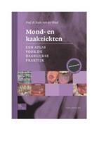 Mond- en kaakziekten