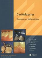 Prelum Uitgevers Carieslaesies-Studenteneditie - A.J.P. van Strijp