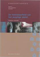 De kwetsbaarheid van het jeugdige skelet: onderste extremiteit
