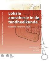 Lokale anesthesie in de tandheelkunde