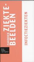 Zakboek ziektebeelden Infectieziekten