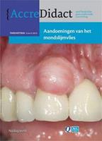 Aandoeningen van het mondslijmvlies