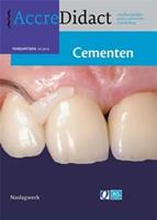   Cementen
