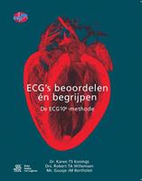 ECG's - beoordelen én begrijpen