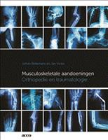 Musculoskeletale aandoeningen