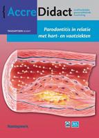 Parodontitis in relatie met hart- en vaatziekten