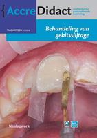 Behandeling van gebitsslijtage