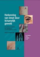 Herkenning van letsel door lichamelijk geweld