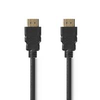 Quality4All HDMI kabel - 1.5 meter - Zwart - 