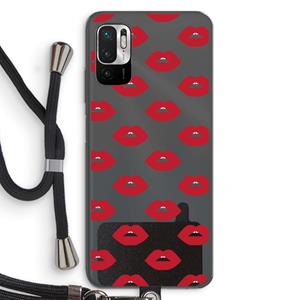 CaseCompany Lips: Xiaomi Redmi Note 10 5G Transparant Hoesje met koord