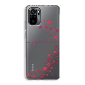 Kusjes: Xiaomi Redmi Note 10 Pro Transparant Hoesje