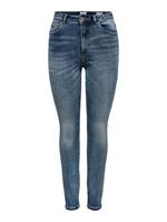 Skinny Jeans Only ONLMILA HW SK ANK DNM BJ13994