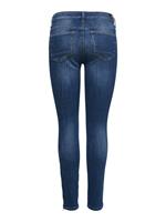 Only Skinny fit jeans ONLKENDELL LIFE met rits bij de zoom