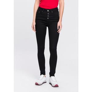 Arizona Skinny-fit-Jeans "Ultra Stretch", High Waist mit durchgehender Knopfleiste