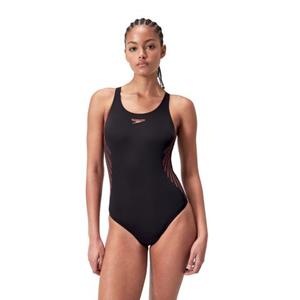 Speedo Placement Muscleback